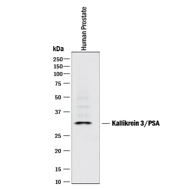 Detection of Human Kallikrein 3/PSA antibody by Western Blot.