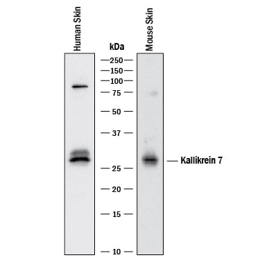 Detection of Human and Mouse Kallikrein 7 antibody by Western Blot.