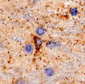Katanin p60 antibody in Human Brain by Immunohistochemistry (IHC-P).