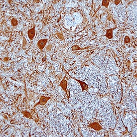 Kininogen antibody in Human Brain by Immunohistochemistry (IHC-P).