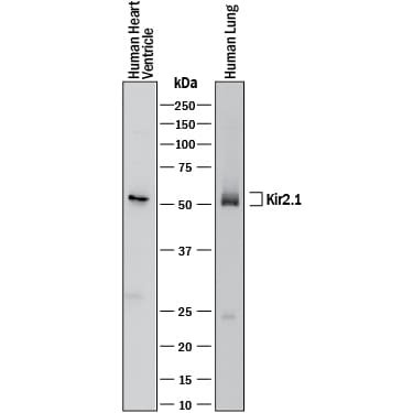 Detection of Human Kir2.1 antibody by Western Blot.