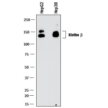 Detection of Human Klotho  beta  antibody by Western Blot.