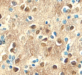 L1CAM antibody in Human Brain by Immunohistochemistry (IHC-P).