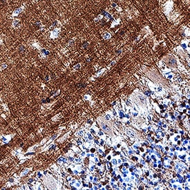 L1CAM antibody in Human Brain (Cerebellum) by Immunohistochemistry (IHC-P).