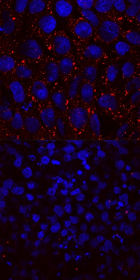 L1TD1 antibody in BG01V Human Embryonic Stem Cells by Immunocytochemistry (ICC).