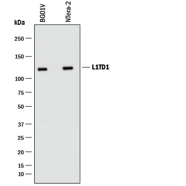 Detection of Human L1TD1 antibody by Western Blot.