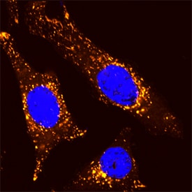 LAMP1/CD107a antibody in HeLa Human Cell Line by Immunocytochemistry (ICC).