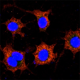 LAMP1/CD107a antibody in HeLa Human Cell Line by Immunocytochemistry (ICC).