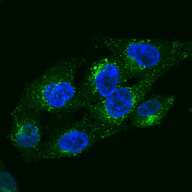 LAMP1/CD107a antibody in HeLa Human Cell Line by Immunocytochemistry (ICC).