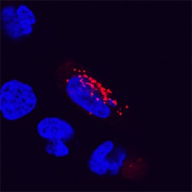 LAMP2/CD107b antibody in HeLa Human Cell Line by Immunocytochemistry (ICC).