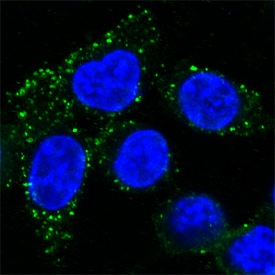 LAMP2/CD107b antibody in HeLa Human Cell Line by Immunocytochemistry (ICC).