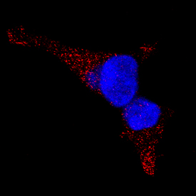 LAMP2/CD107b antibody in HEK293 Human Cell Line by Immunocytochemistry (ICC).