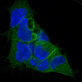 LAP (TGF-beta 1) antibody in HEK293 Human Cell Line by Immunocytochemistry (ICC).