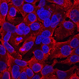 LGI2 antibody in HepG2 Human Cell Line by Immunocytochemistry (ICC).