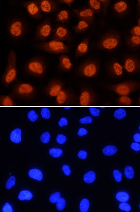 LIMD1 antibody in HeLa Human Cell Line by Immunocytochemistry (ICC).
