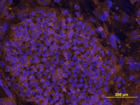 LIN-41 antibody in BG01V Human Stem Cells by Immunocytochemistry (ICC).