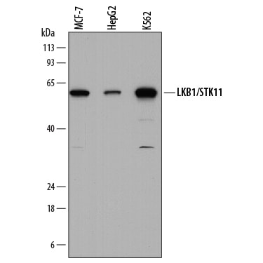 Detection of Human LKB1/STK11 antibody by Western Blot.