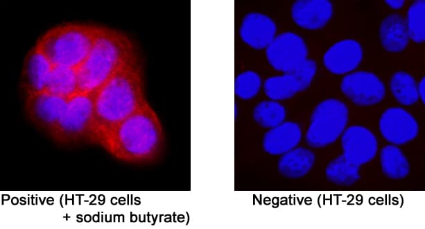 LPAR5/LPA5/GPR92 antibody in HT-29 Human Cell Line by Immunocytochemistry (ICC).