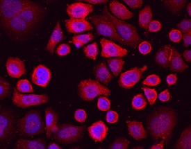 LRIG1 antibody in SK-BR-3 Human Cell Line by Immunocytochemistry (ICC).