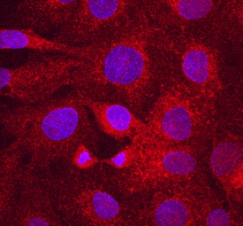 LRP-6 antibody in DU145 Human Cell Line by Immunocytochemistry (ICC).