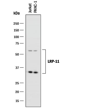 Detection of Human LRP-11 antibody by Western Blot.