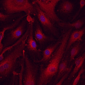 LRRC32/GARP antibody in bEnd by Immunocytochemistry (ICC).3 Mouse Cell Line by Immunocytochemistry (ICC).