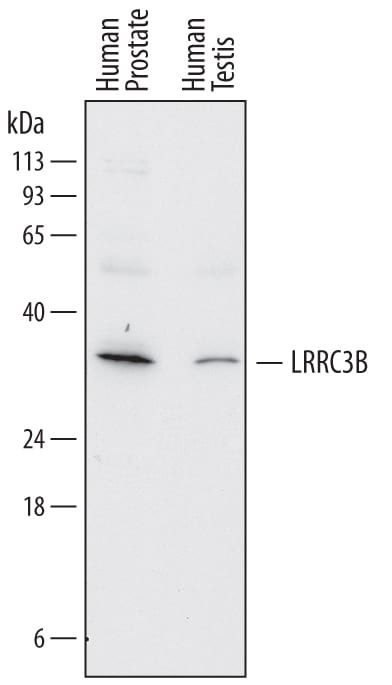 Detection of Human LRRC3B antibody by Western Blot.