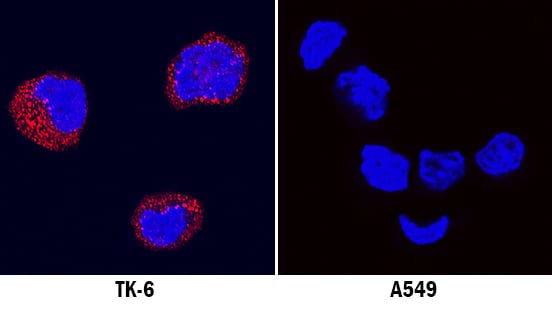 LRTM1 antibody in TK-6 and A549 Human Cell Lines by Immunocytochemistry (ICC).