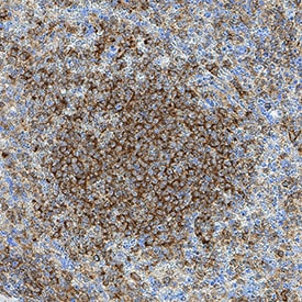 LRTM1 antibody in Human Spleen by Immunohistochemistry (IHC-P).