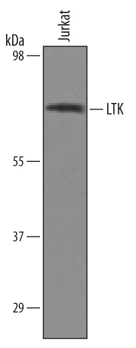 Detection of Human LTK antibody by Western Blot.