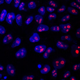 LYAR antibody in BG01V Human Embryonic Stem Cells by Immunocytochemistry (ICC).