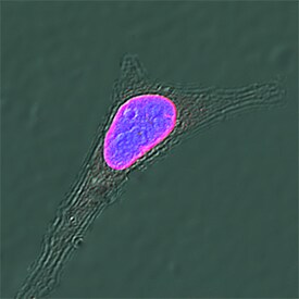 Lamin B1 antibody in HeLa Human Cell Line by Immunocytochemistry (ICC).