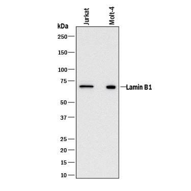 Detection of Human Lamin B1 antibody by Western Blot.