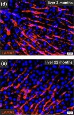 Immunohistochemistry: Laminin alpha 5 Antibody (CL3118) [NBP2-42391] -
