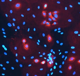Laminin a3/Laminin-5 antibody in NHEK Human Cell Line by Immunocytochemistry (ICC).