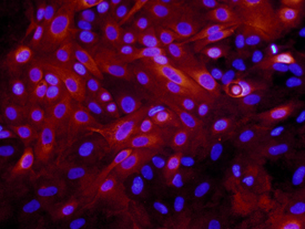 Laminin a3/Laminin-5 antibody in MCF 10A Human Cell Line by Immunocytochemistry (ICC).