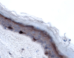 Langerin/CD207 antibody in Human Skin by Immunohistochemistry (IHC-P).