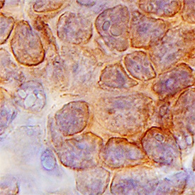 Lck antibody in Human Thymus by Immunohistochemistry (IHC-P).