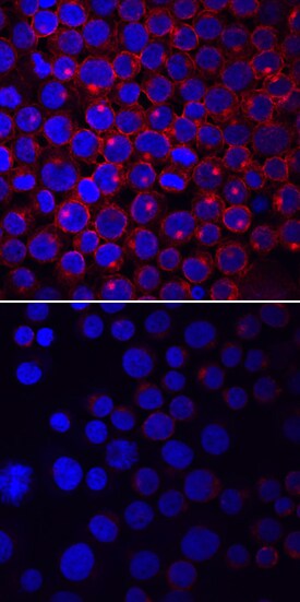 Phospho-Lck (Y505) antibody in Jurkat Human Cell Line by Immunocytochemistry (ICC).