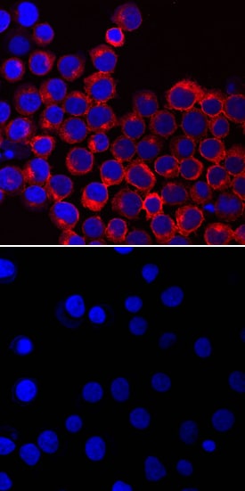 Phospho-Lck (Y394) antibody in Jurkat Human Cell Line by Immunocytochemistry (ICC).