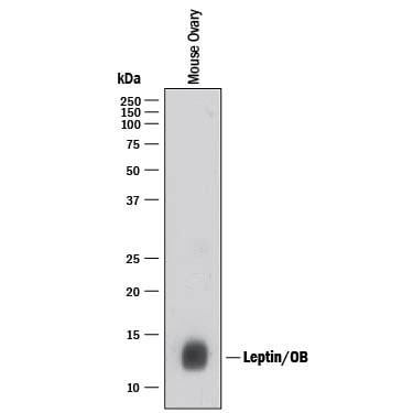 Detection of Mouse Leptin/OB antibody by Western Blot.
