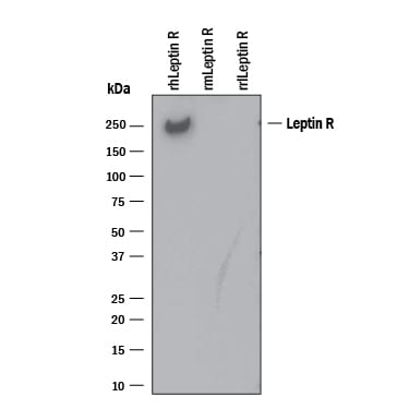 Detection of Recombinant Human Leptin R antibody by Western Blot.