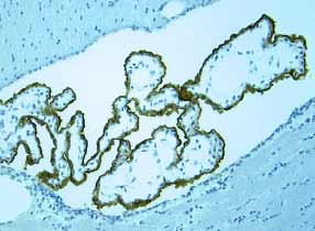 Leptin R antibody in Rat Brain by Immunohistochemistry (IHC-Fr).