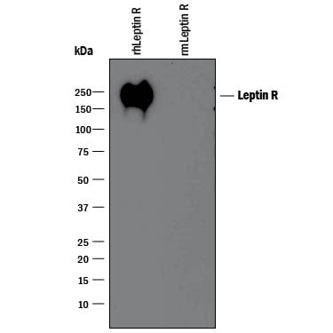 Detection of Recombinant Human Leptin R antibody by Western Blot.