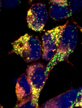 Lgr5/GPR49 antibody in HEK293 Human Cell Line Transfected with Mouse Lgr5/GPR49 by Immunocytochemistry (ICC).