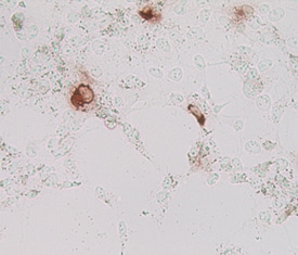 Lgr5/GPR49 antibody in Human Cells Transfected with Human Lgr5/GPR49 by Immunocytochemistry (ICC).