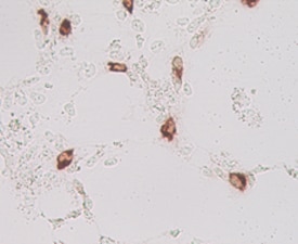 Lgr5/GPR49 antibody in Mouse Cells Transfected with Mouse Lgr5/GPR49 by Immunocytochemistry (ICC).