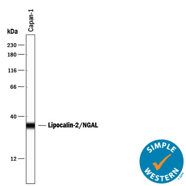 Detection of Human Lipocalin‑2/NGAL antibody by Simple WesternTM.