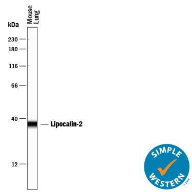Detection of Mouse Lipocalin‑2/NGAL antibody by Simple WesternTM.