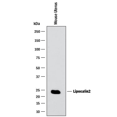Detection of Mouse Lipocalin-2/NGAL antibody by Western Blot.